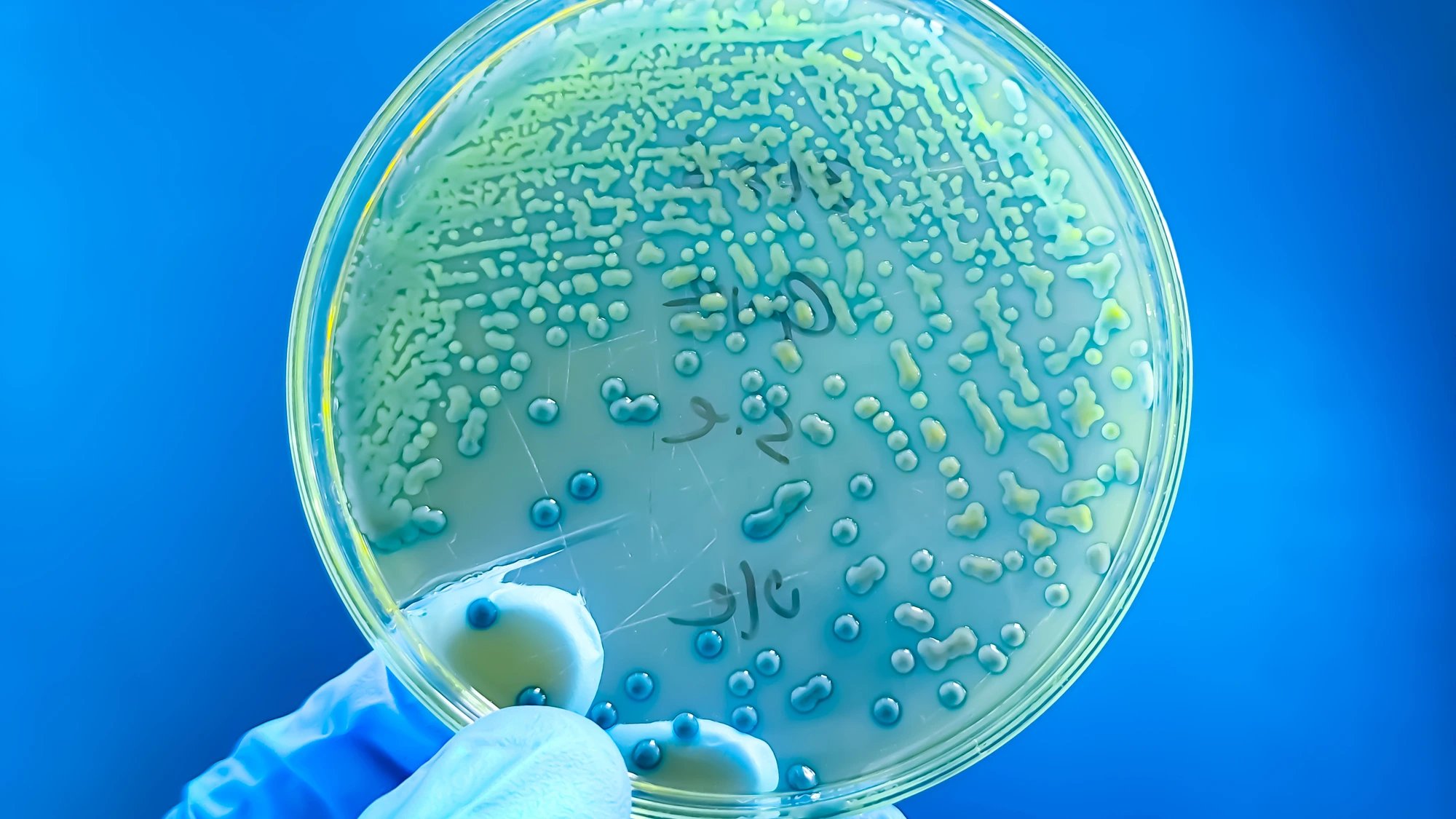 Childhood antibiotic resistance rises globally, study projects steep increases by 2035