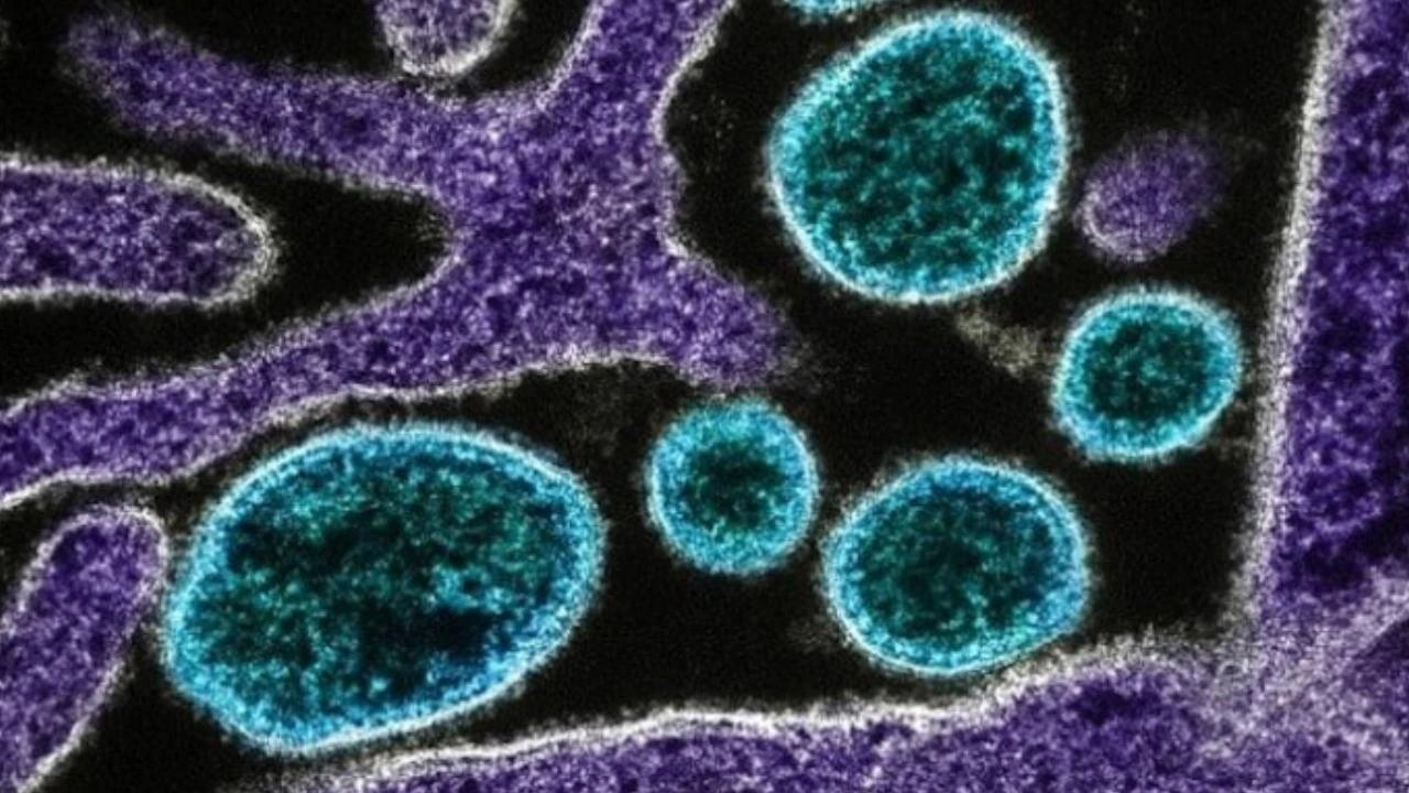 Stanford researchers use AI to create 16 new viruses targeting E. coli