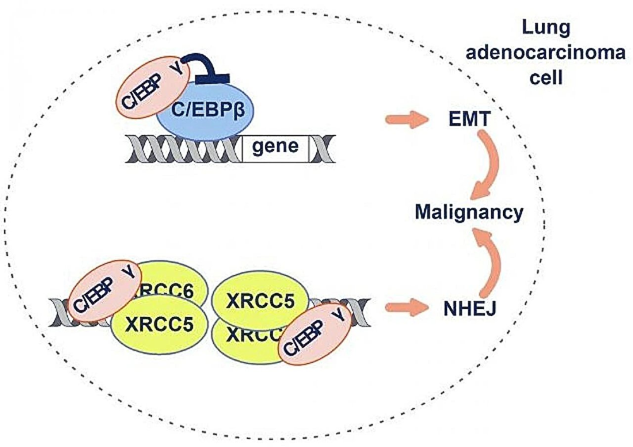 Researchers Identify C/EBPγ Protein Linking EMT and DNA Repair in Lung Adenocarcinoma