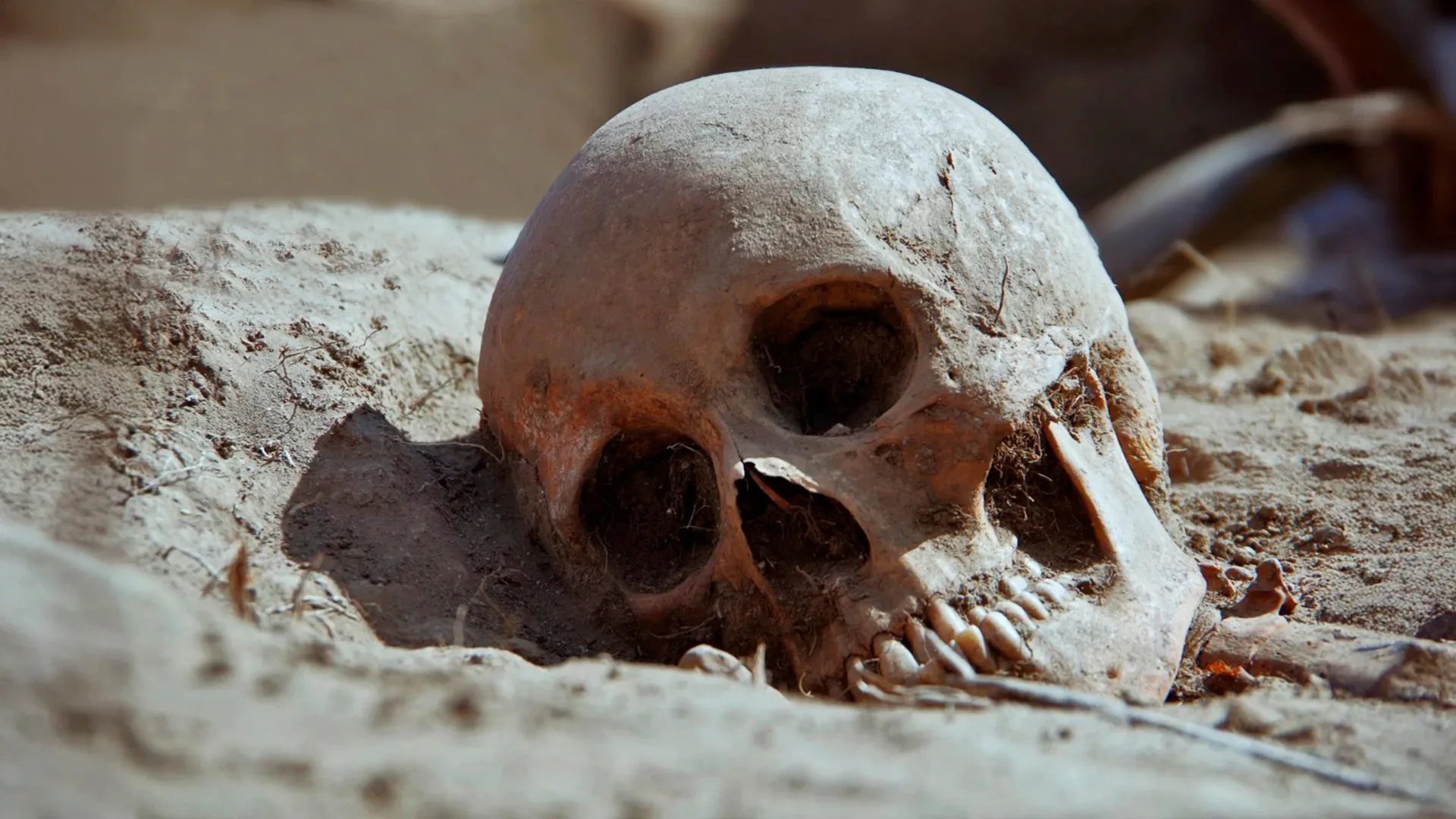 Charles Sturt University study of 3,500-year-old Vietnamese skeletons challenges syphilis diagnosis assumption