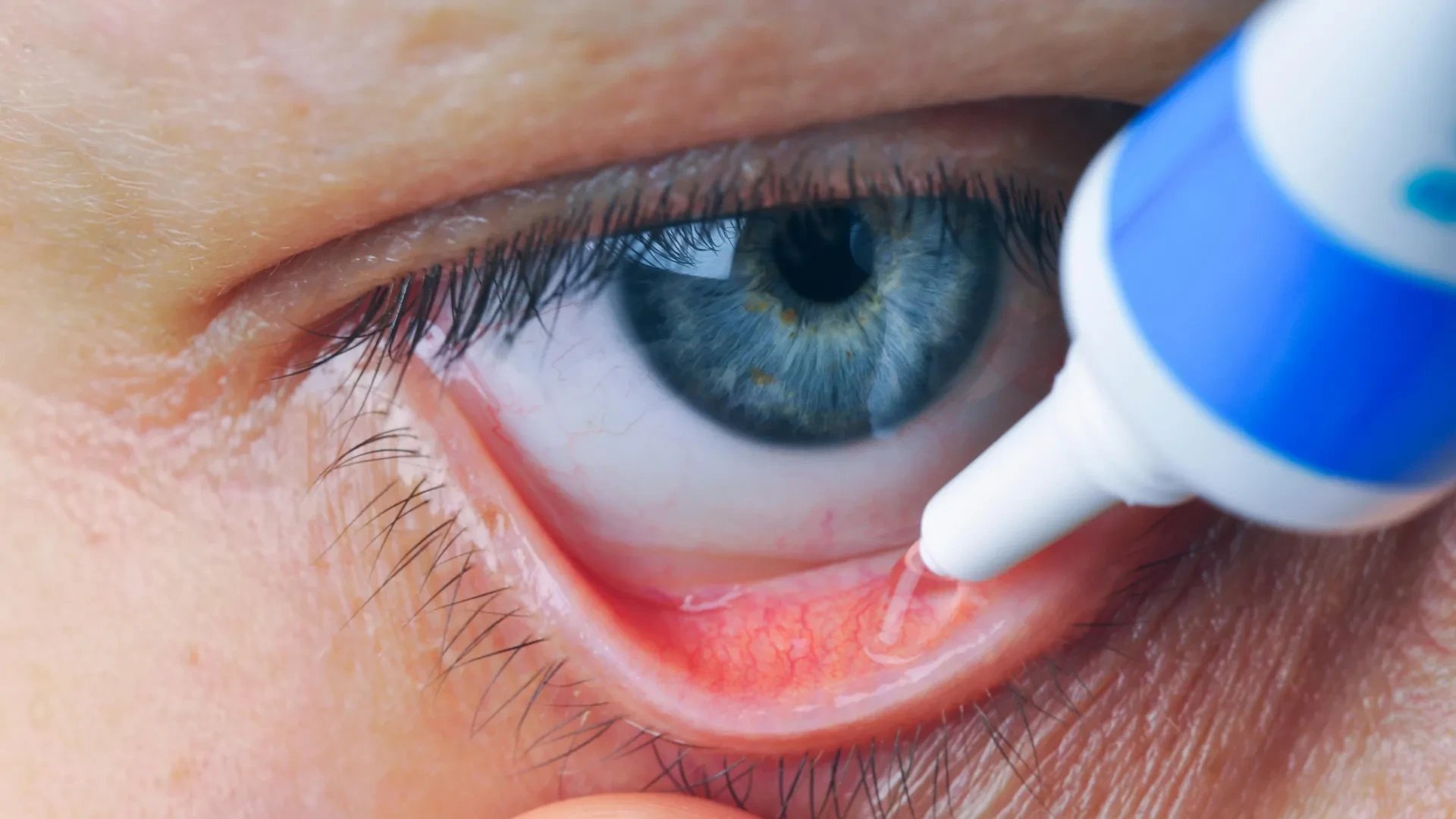 Experimental eye drops restore sight in blind mice