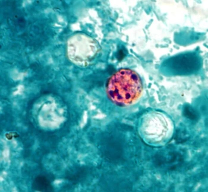 USDA halts Cyclospora research as outbreak reaches 30,000 cases