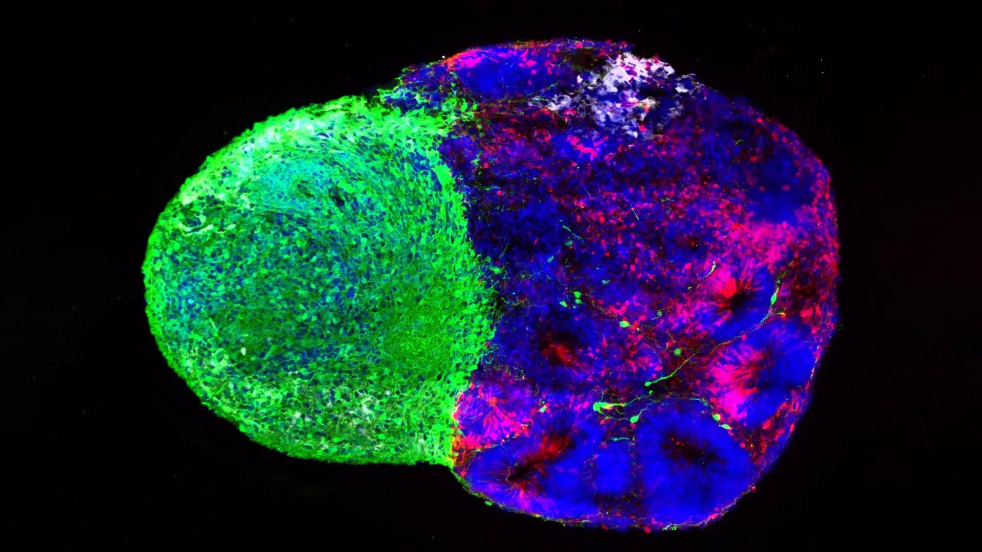 Scientists map metabolic signals that steer human brain stem cell decisions