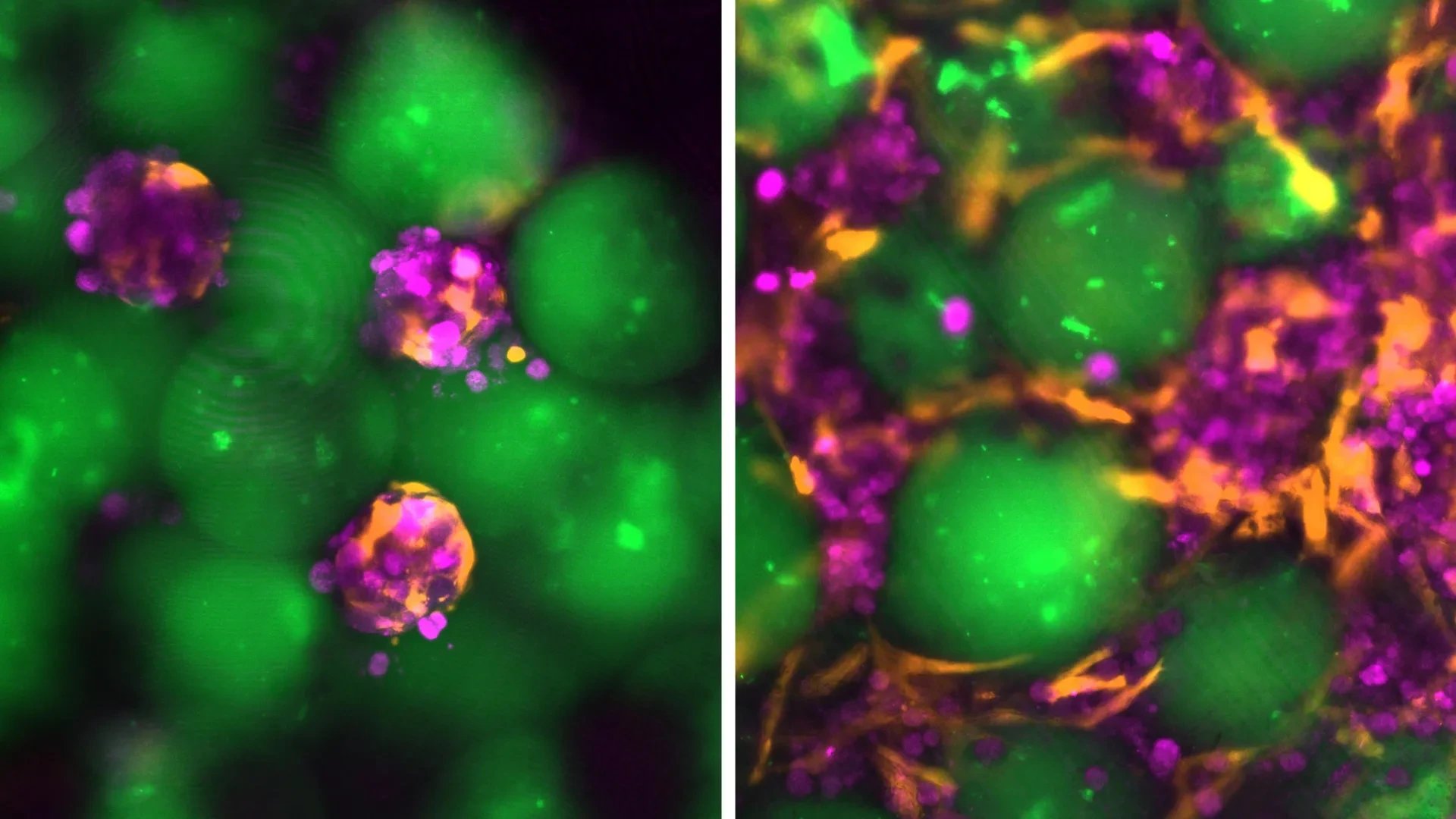 MIT scientists develop injectable mini livers that work inside the body
