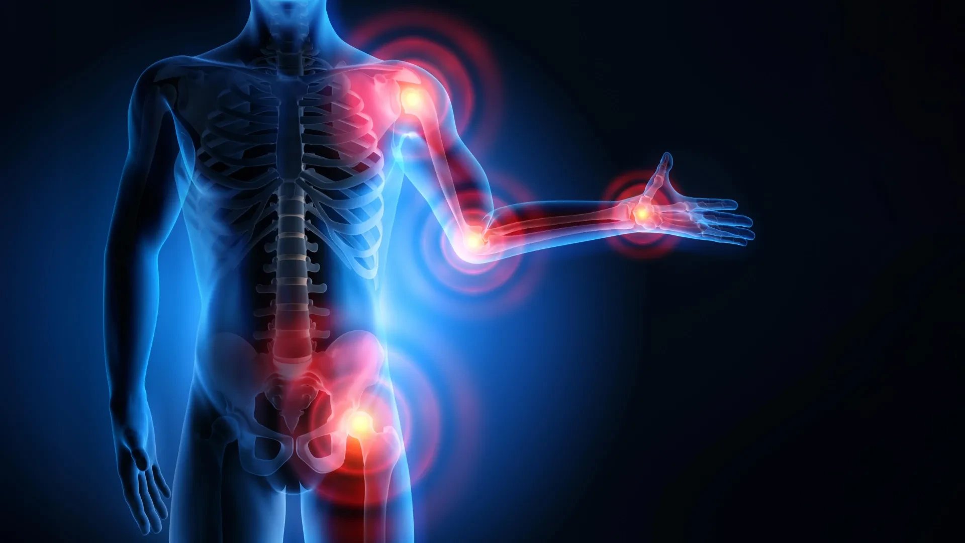 UCL scientists identify epoxy-oxylipins as natural brake on inflammation