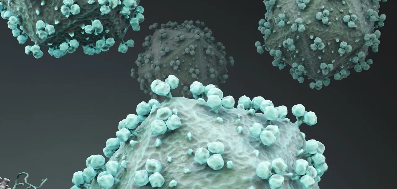 Antibody infusions keep HIV in check for years in some patients