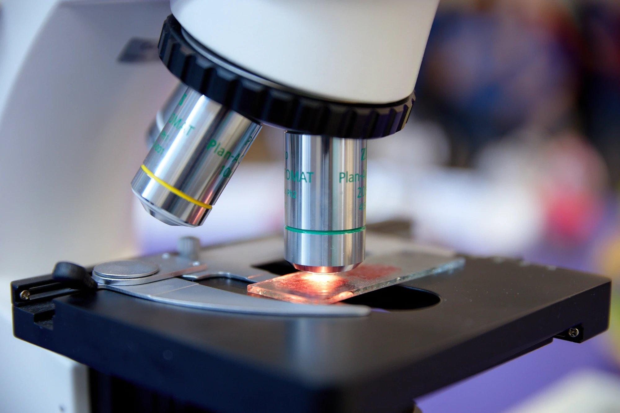 UVA Health: фокусированный ультразвук открыл доступ лекарств к глиоме у мышей