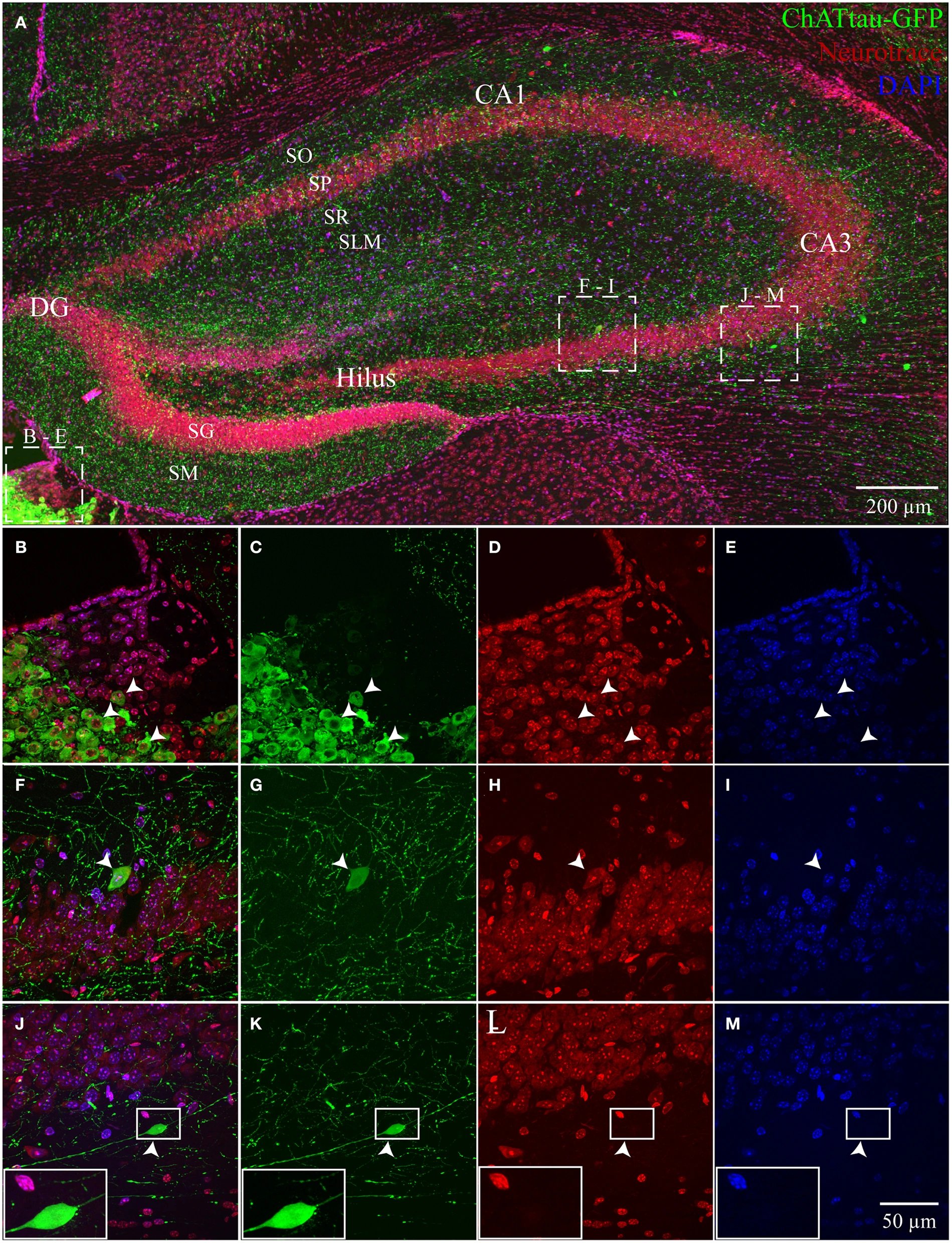 Nature study identifies PV neuron plasticity mechanism across four neurodevelopmental disorders