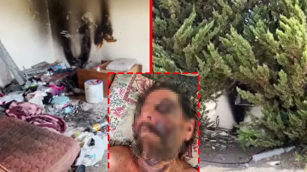 Izmir man survives brain hemorrhage and pneumonia after being beaten, left in abandoned building