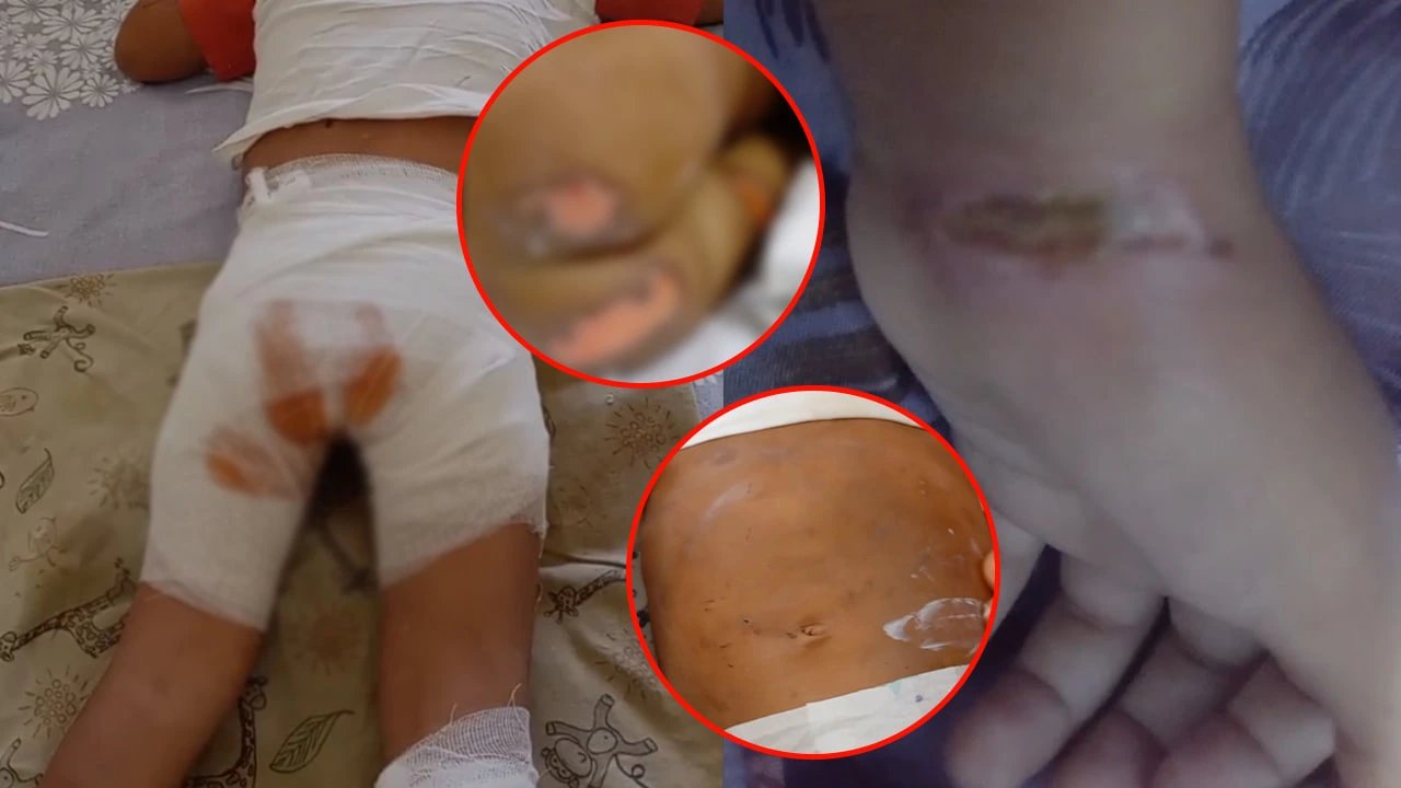 Three-year-old in Samarkand region allegedly tortured by nanny, left on hot stove