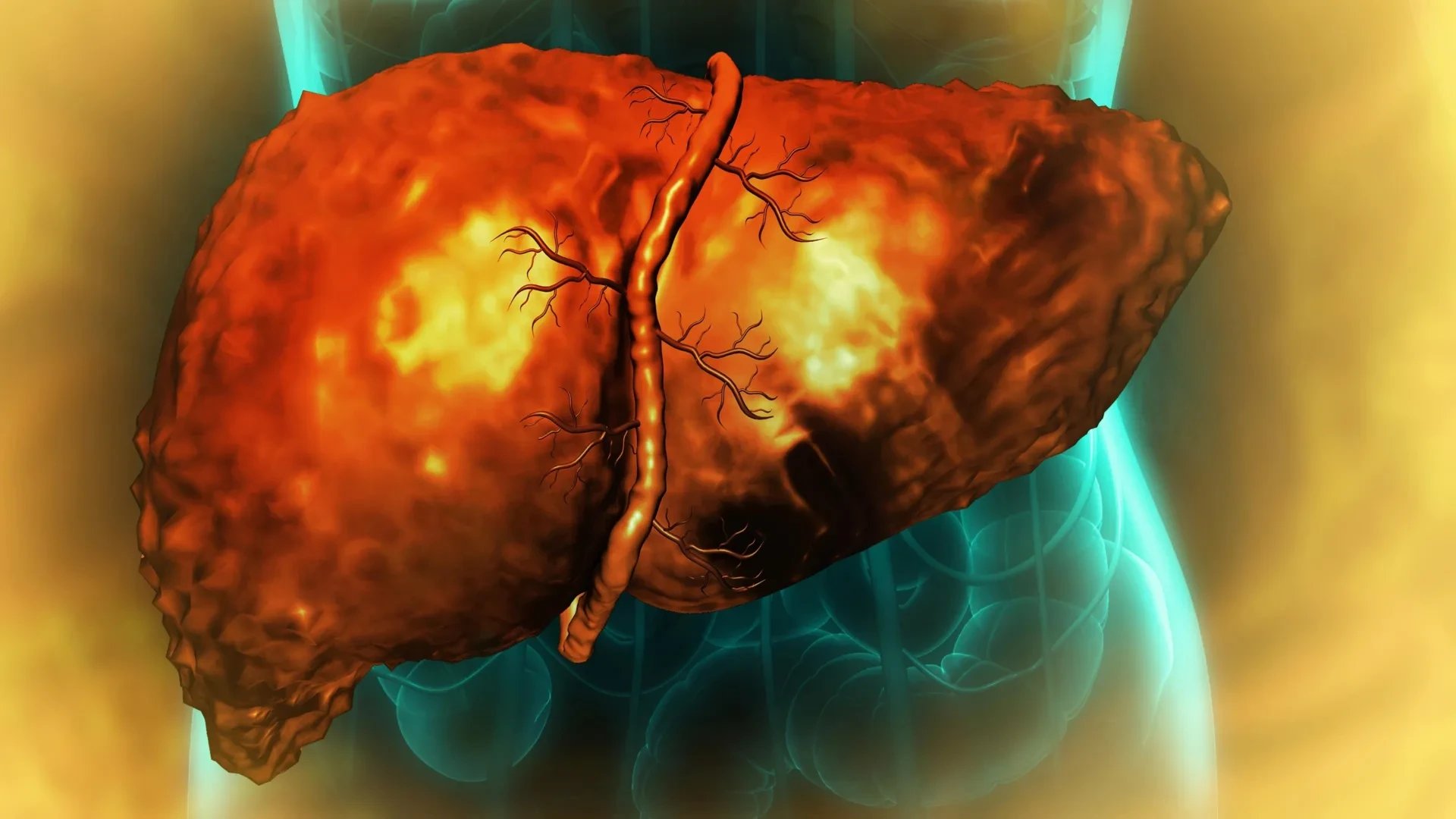 Inflammation traps liver cells in abnormal state, blocking regeneration after alcohol damage