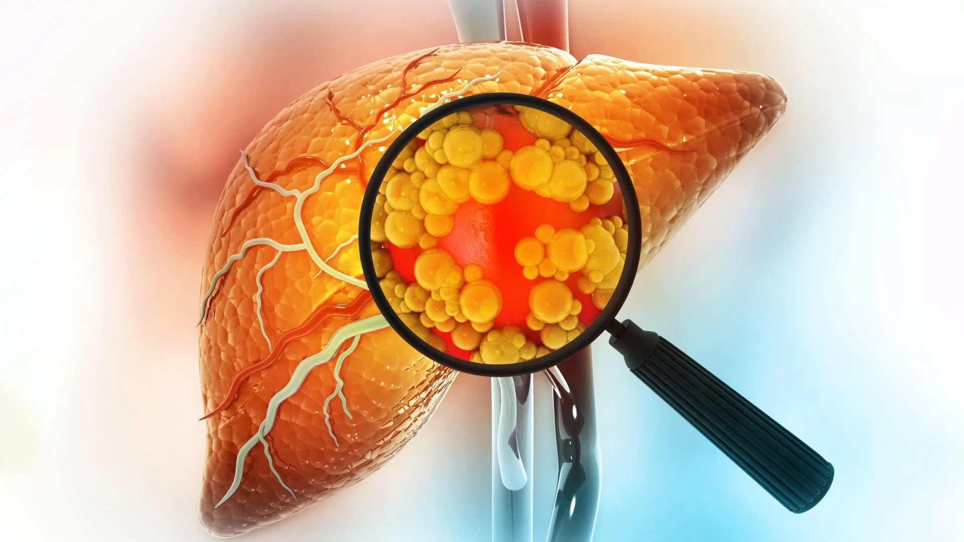 Sorbitol sweetener converts to fructose in gut, WashU study finds