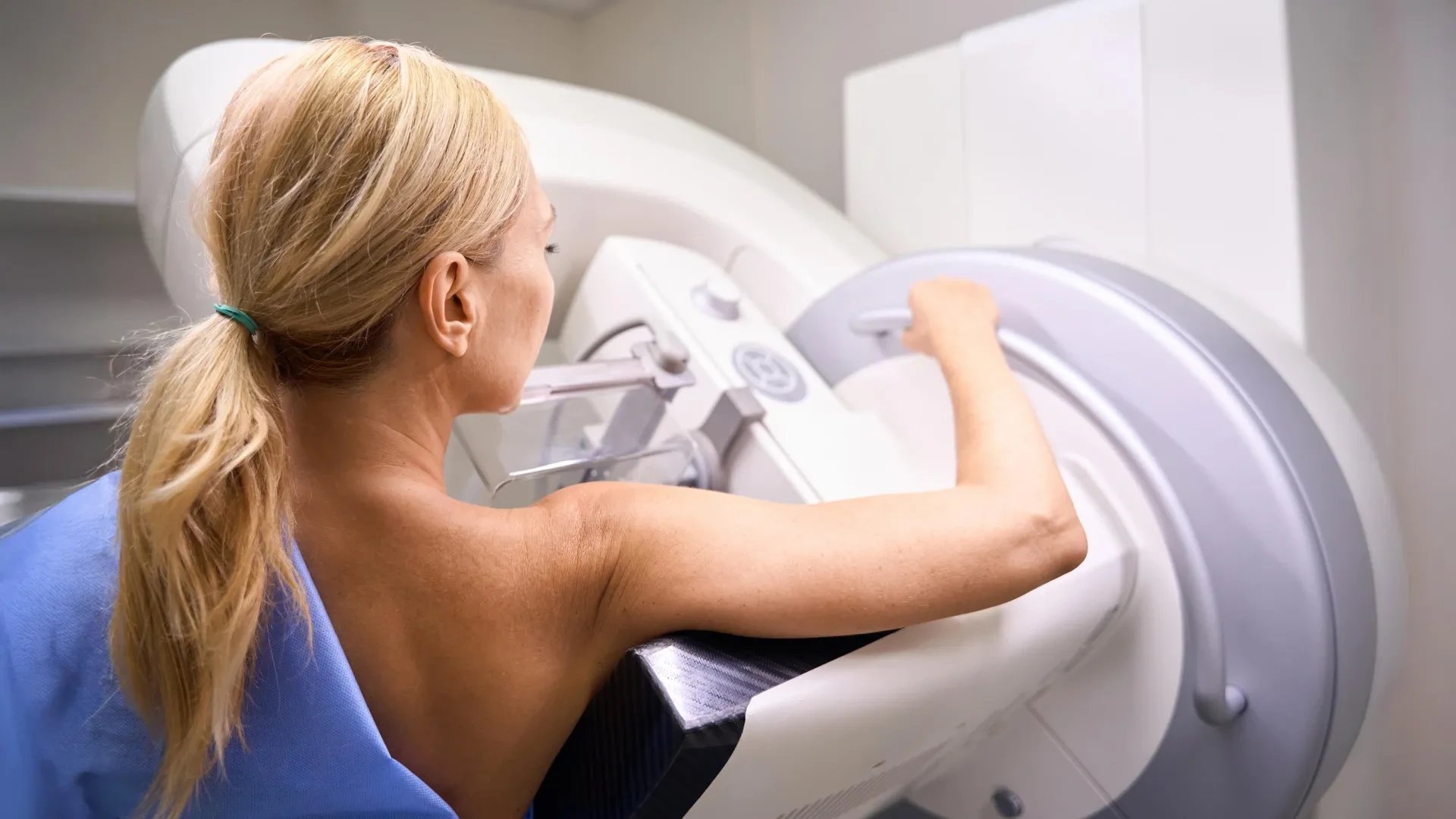 Breast cancer screening overdiagnosis may be far lower than trials suggested